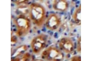 Used in DAB staining on fromalin fixed paraffin-embedded Kidney tissue (PKC zeta anticorps  (AA 254-484))