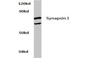 Western blot analysis of Synapsin-1 Antibody  in extracts from Hela cells at 1/500 dilution. (SYN1 anticorps)