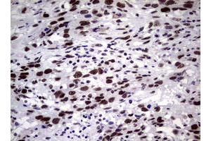 Image no. 20 for anti-Nibrin (NBN) (AA 183-460) antibody (ABIN1491066)