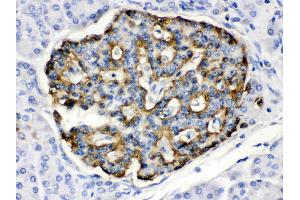 APOBEC3G was detected in paraffin-embedded sections of human pancreatic cancer tissues using rabbit anti- APOBEC3G Antigen Affinity purified polyclonal antibody (Catalog # ) at 1 ?