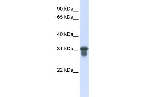 WB Suggested Anti-SLC25A11 Antibody Titration:  0. (SLC25A11 anticorps  (C-Term))