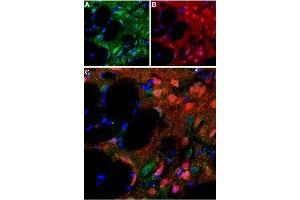 Expression of D5 dopamine receptor in rat striatum - Immunohistochemical staining of perfusion-fixed rat brain frozen using Anti-D5 Dopamine Receptor (extracellular) Antibody (ABIN7043111, ABIN7044234 and ABIN7044235), (1:100). (DRD5 anticorps  (2nd Extracellular Loop))