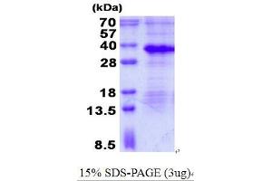 Image no. 1 for Microfibrillar Associated Protein 2 (MFAP2) protein (His tag) (ABIN1098693)
