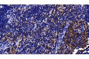 Detection of IL1RAP in Rat Thymus Tissue using Polyclonal Antibody to Interleukin 1 Receptor Accessory Protein (IL1RAP)