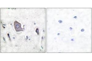 Immunohistochemistry analysis of paraffin-embedded human brain, using Trk B (Phospho-Tyr705) Antibody. (TRKB anticorps  (pTyr706))