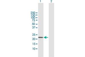 Western Blot analysis of TNFRSF17 expression in transfected 293T cell line by TNFRSF17 MaxPab polyclonal antibody.