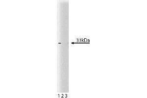 Western blot analysis of Cdk4 on a RSV-3T3 lysate. (CDK4 anticorps  (AA 1-303))