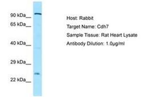 Image no. 1 for anti-Cadherin 7 (CDH7) (AA 51-100) antibody (ABIN6749910) (Cadherin 7 anticorps  (AA 51-100))