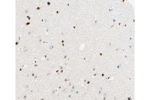 ABIN6266815 at 1/100 staining human brain tissue sections by IHC-P. (THRB anticorps  (Internal Region))