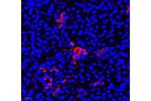 Immunofluorescence of paraffin embedded human pancreas using Aldh4a1 (ABIN7073000) at dilution of 1: 400 (400x lens)