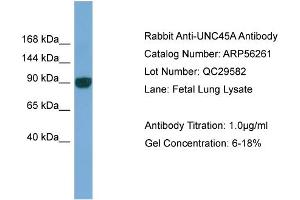 WB Suggested Anti-UNC45A  Antibody Titration: 0. (UNC45A anticorps  (N-Term))