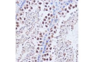 Immunohistochemistry of paraffin-embedded mouse testis using BRD4 antibody (ABIN6127508, ABIN6137653, ABIN6137654 and ABIN7101457) at dilution of 1:100 (40x lens). (BRD4 anticorps  (AA 1100-1200))