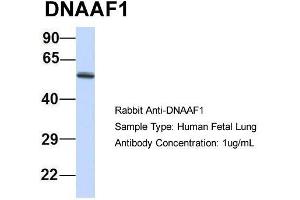 Host: Rabbit  Target Name: DNAAF1  Sample Tissue: Human Fetal Lung  Antibody Dilution: 1.