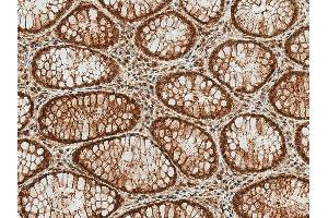 Immunohistochemistry analysis using Rabbit Anti-HSP70 (Acetyl Lys77) Polyclonal Antibody (ABIN5650774).