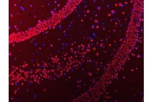 IF analysis of hnRNP U/p120/HNRNPU using anti-hnRNP U/p120/HNRNPU antibody (ABIN7600979).