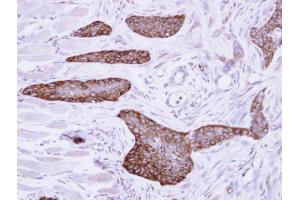 IHC-P Image Immunohistochemical analysis of paraffin-embedded H661 xenograft, using MCD, antibody at 1:500 dilution.