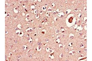 Immunohistochemistry of paraffin-embedded human brain tissue using ABIN7143254 at dilution of 1:100