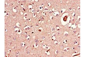 Immunohistochemistry of paraffin-embedded human brain tissue using ABIN7143254 at dilution of 1:100 (Acylglycerol Kinase anticorps  (AA 32-65))