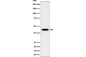 Western blot analysis of ITPK1 expression in HepG2 cell lysate.