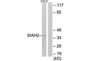 Western blot analysis of extracts from COLO cells, using SIAH2 Antibody. (SIAH2 anticorps  (AA 241-290))