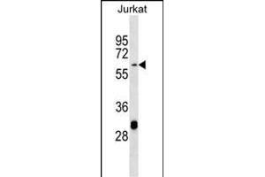 TN3 Antibody (Center) (ABIN656882 and ABIN2846082) western blot analysis in Jurkat cell line lysates (35 μg/lane). (Matrilin 3 anticorps  (AA 220-248))