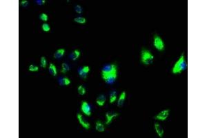 Immunofluorescence staining of Hela cells with ABIN7152965 at 1:100, counter-stained with DAPI.