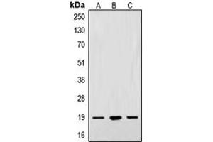 Western blot analysis of Alpha-synuclein expression in A549 (A), SKNSH (B), PC12 (C) whole cell lysates.