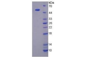 Image no. 1 for Mannan-Binding Lectin Serine Peptidase 1 (MASP1) (AA 25-453) protein (His tag) (ABIN6236800) (MASP1 Protein (AA 25-453) (His tag))