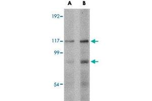 Western blot analysis of FNIP2 in rat skeletal muscle tissue lysate with FNIP2 polyclonal antibody  at (A) 1 and (B) 2 ug/mL . (FNIP2 anticorps  (C-Term))