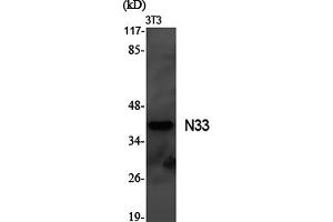 Western Blotting (WB) image for anti-Tumor Suppressor Candidate 3 (TUSC3) antibody (ABIN5961746)