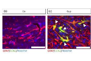 Astrocytes were found to be a source of LCN2 in the corpus callosum of wild type Cup mice using GFAP (red) - LCN2 (green) immunohistochemical double staining.
