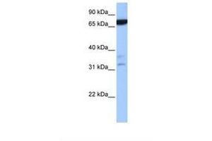 Image no. 1 for anti-Zinc Finger Protein 340 (ZNF340) (N-Term) antibody (ABIN6739296) (ZBTB46 anticorps  (N-Term))