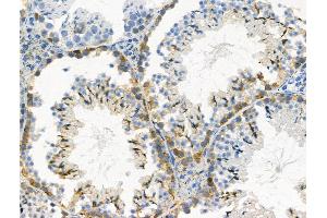 Phospho-ZO-2 (Tyr1118) Antibody at 1/100 staining Mouse testis tissue by IHC-P.