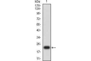 Western blot analysis using ACTH mAb against human ACTH recombinant protein. (ACTH anticorps)
