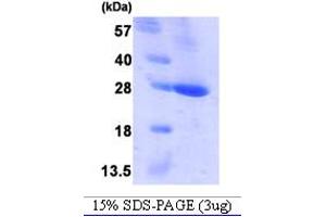 SDS-PAGE (SDS) image for B-Cell CLL/lymphoma 2 (BCL2) (AA 1-211) protein (His tag) (ABIN667734)