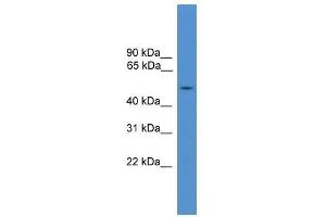 IL7R antibody used at 0. (IL7R anticorps  (Middle Region))