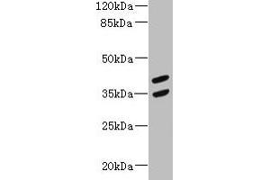Western blot All lanes: MAGEB10 antibody at 12 μg/mL + Mouse heart tissue Secondary Goat polyclonal to rabbit IgG at 1/10000 dilution Predicted band size: 39 kDa Observed band size: 39, 35 kDa (MAGEB1 anticorps  (AA 1-300))
