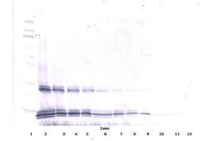 Image no. 1 for anti-Interleukin 15 (IL15) antibody (ABIN465268) (IL-15 anticorps)