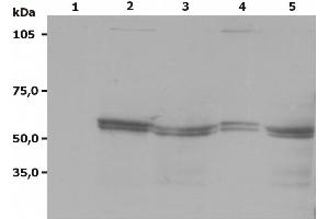 Western Blotting analysis (non-reducing conditions) of Lyn using anti-Lyn (LYN-01).