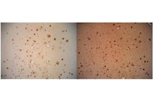 Immunohitsochemistry analysis of Amyloid Fibrils (OC) in Human AD brain, showing no Amyloid Precursor Protein (APP) cross-reactivity (Left), but when conducted with monoclonal 6E10 (Right) shows considerable APP cross-reactivity. (Amyloid Fibrils anticorps)