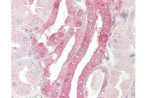 Anti-CELF3 antibody IHC staining of human kidney. (CELF3 anticorps  (AA 3-32))