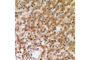 Immunohistochemical analysis of CD265 staining in human liver formalin fixed paraffin embedded tissue section.