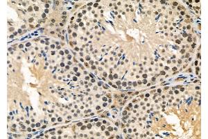 ABIN6258658 and ABIN6274958 at 1/100 staining Mouse testis tissue by IHC-P. (CA13 anticorps  (Internal Region))