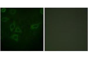 Immunofluorescence (IF) image for anti-Thymidine Kinase 1, Soluble (TK1) (AA 1-50) antibody (ABIN2888706) (TK1 anticorps  (AA 1-50))
