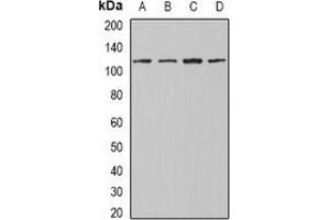 Western blot analysis of INTS4 expression in Jurkat (A), A549 (B), mouse testis (C), mouse heart (D) whole cell lysates. (INTS4 anticorps)