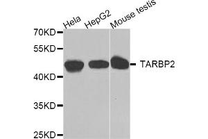 Western blot analysis of extracts of various cell lines, using TARBP2 antibody (ABIN5974736) at 1/1000 dilution. (TARBP2 anticorps)