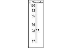 Western blot analysis of OR9Q1 Antibody (C-term) in mouse Neuro-2a cell line lysates (35ug/lane). (OR9Q1 anticorps  (C-Term))