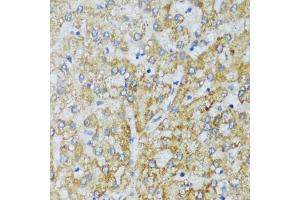 Immunohistochemistry of paraffin-embedded human liver using C1QC antibody (ABIN7266475) at dilution of 1:100 (40x lens). (C1QC anticorps  (AA 50-150))