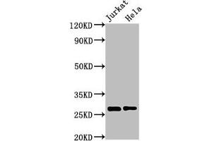 Western Blot Positive WB detected in: Jurkat whole cell lysate, Hela whole cell lysate All lanes: HSD17B10 antibody at 3 μg/mL Secondary Goat polyclonal to rabbit IgG at 1/50000 dilution Predicted band size: 27, 26 kDa Observed band size: 27 kDa
