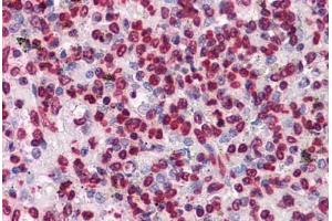 Human Spleen: Formalin-Fixed, Paraffin-Embedded (FFPE) (HIPK1 anticorps  (AA 330-430))